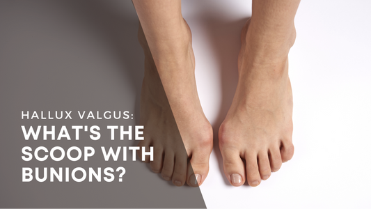 Hallux Valgus: What's the scoop with bunions?