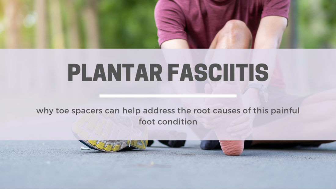 Toe spacers and plantar fasciitis